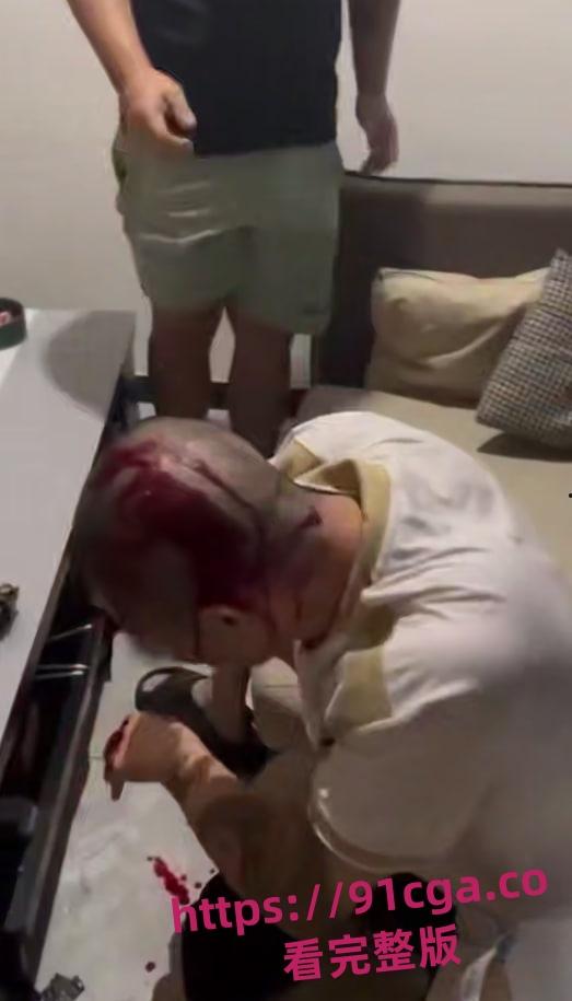 中国绑匪在菲律宾内讧 上演血腥狗咬狗 头破血流枪口相向