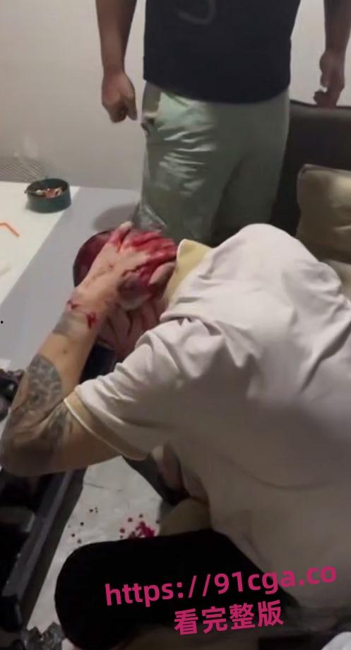 中国绑匪在菲律宾内讧 上演血腥狗咬狗 头破血流枪口相向