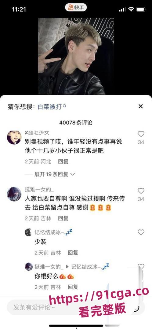 快手网红精神小伙「白菜」遭遇暴打黑历史曝光！酒店内群殴引发热议！