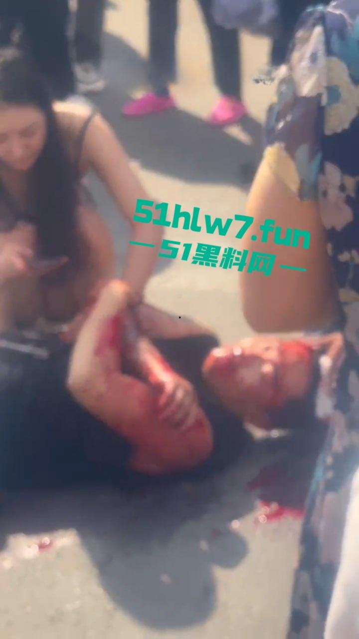 情侣街头误惹地痞流氓惨遭群殴,女友拼命拉架奈何小伙还是被砍数刀大街上躺板板。-7