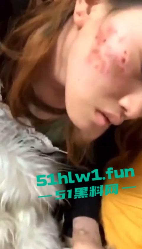 网传河南信阳病毒母体出入啤酒森林酒吧!毒王身体浑身溃烂吓退大量好友,当地交友群已炸开锅!-7