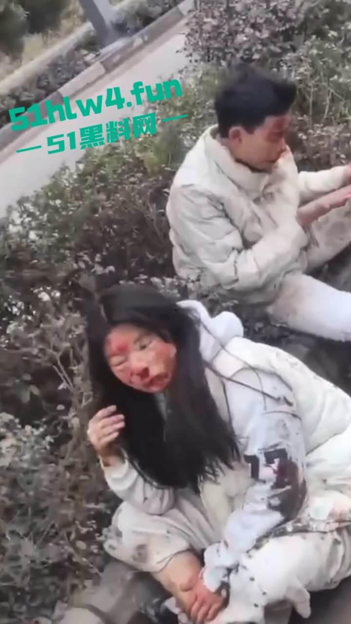 内江资中奇葩车祸五菱宏光加速超车，竟然失控出车祸俩人都变成熊猫脸，看着太搞笑了。-4