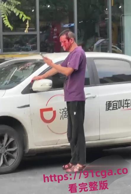 南京女子坐网约车要求司机送进小区!司机拒绝后被女子丈夫持扳手砸伤脑袋!-7