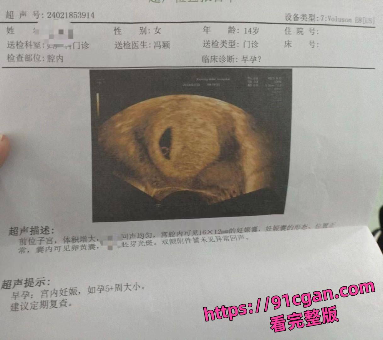 旷世渣男将涉世未深的14岁学生妹 冯颖 搞怀孕后还到处炫耀自己的成果极其下头!-7