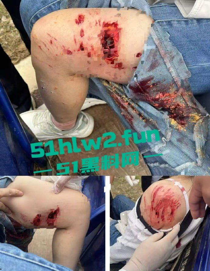 江西赣州四条大型犬公园撕咬母女原视频，狗主人拒绝赔偿系当地小老板，引起了广大网友们热议。