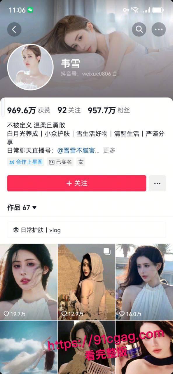 惊天大瓜！网红韦雪整容改命，设局秦奋索 9 亿分手费，如今遭前夫现任联手背刺-5