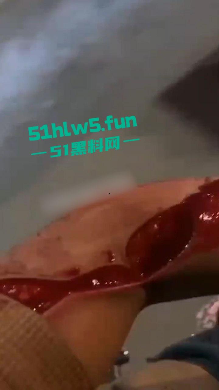 重口血腥场面慎点！广东普宁cw电竞社精神小伙线下真实暴砍对手致皮开肉绽。