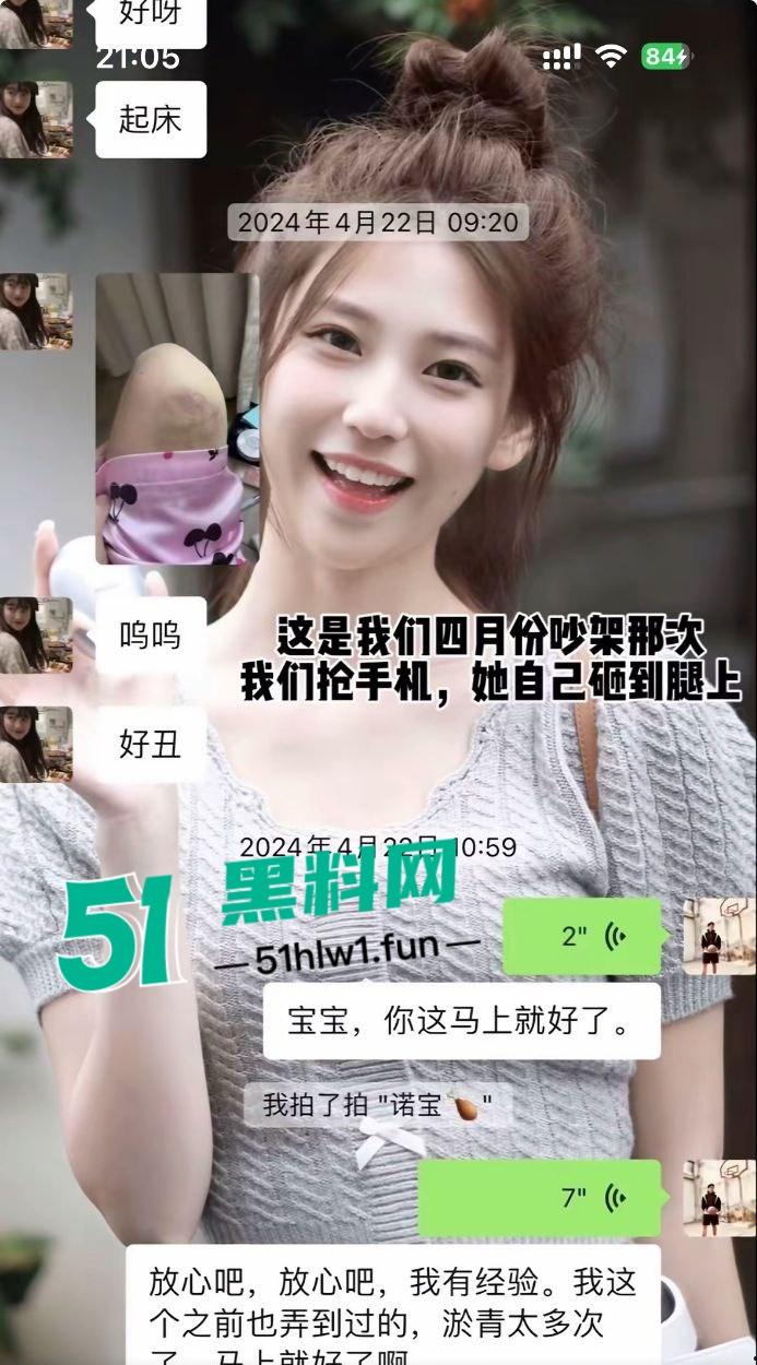 两位抖音百万网红，前CUBA成员【程鑫凯】家暴【鸡腿诺】事件持续发酵，未流出资料曝光完整吃瓜。-17