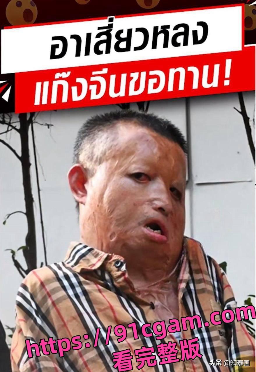 人彘？泰国曼谷惊现中国籍乞讨团！乞讨者失去四肢 且面部严重毁容 ！